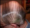 combover.JPG