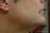 1_RSBeforeShave.JPG