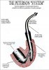 Peterson System cutaway.jpg