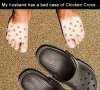 Not Pox Chicken Crocs.jpg