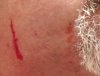 Bloody Cuts.jpg