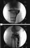 knee-xrays.jpg
