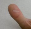 thumb.jpg