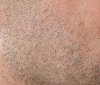 Stubble.jpg