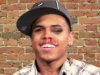 chris-brown-beaten-face-030.jpg